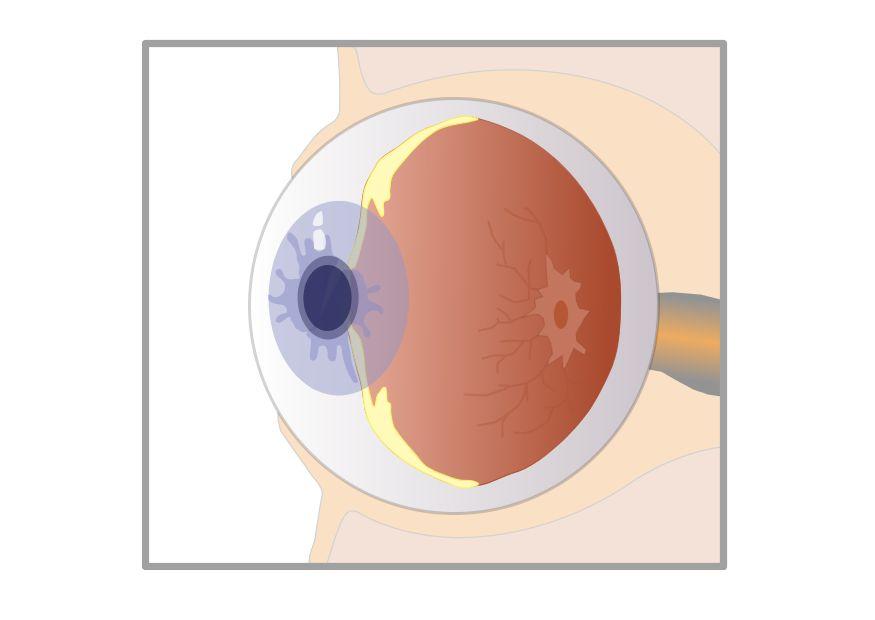 Image cross section egg