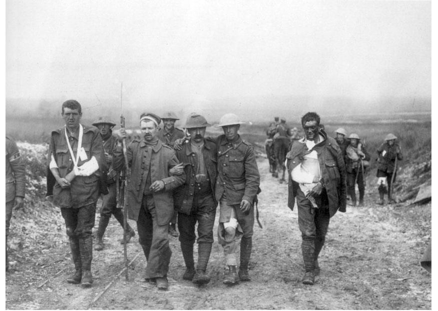 Photo wounded british soldier